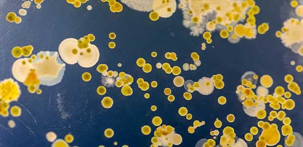 Microbial Growth During Handling, Packaging, Shipping and Storing Contents