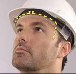 Blurred vision may cause permanent yellow-dotted lines on forehead