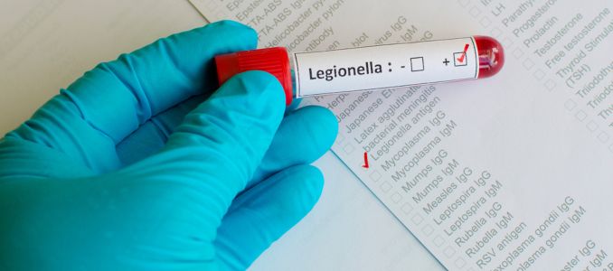 Test Tube With Legionella